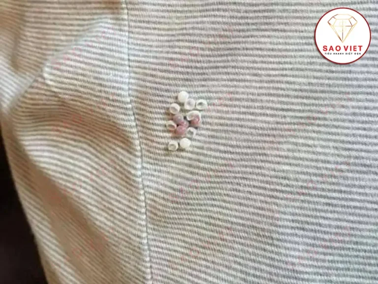 Trứng côn trùng bám vào quần áo