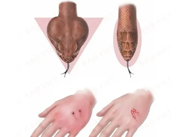So sánh rắn độc và rắn không độc
